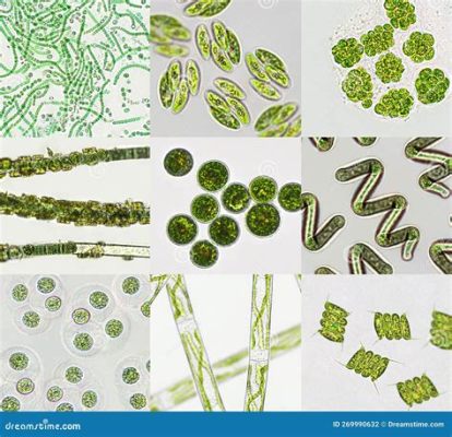  Uroleptus – Uma Criatura Microscópica Que Faz a Festa com Bactérias e Algas!