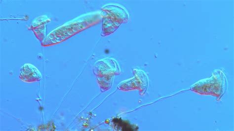  Vorticella! Uma Cilia Fascinante Que Se Move Como Um Pequeno Vórtice